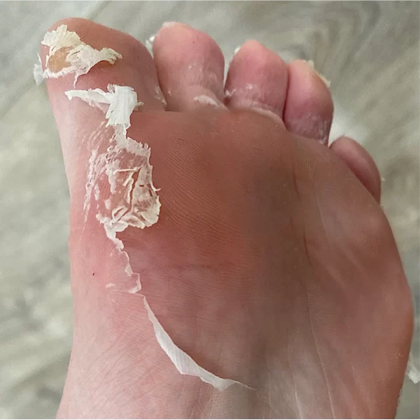 Baby Foot® Men's Foot Peel 4 Pack <span class="package">(Buy 3, Get 4)</span> - Image 3