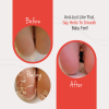 Baby Foot® Original Foot Peel - Image 4