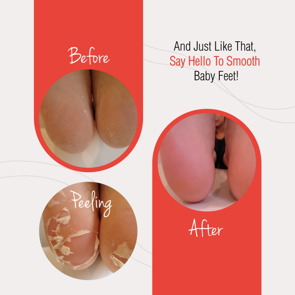 Baby Foot® Exfoliating Foot Peel for Men - Image 4