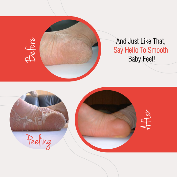 Baby Foot® Exfoliating Foot Peel for Men - Image 5