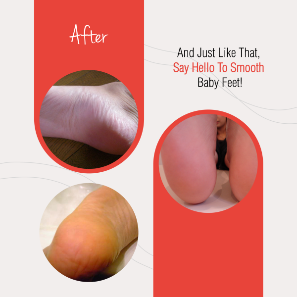 Baby Foot® Exfoliating Foot Peel Mint - Image 3