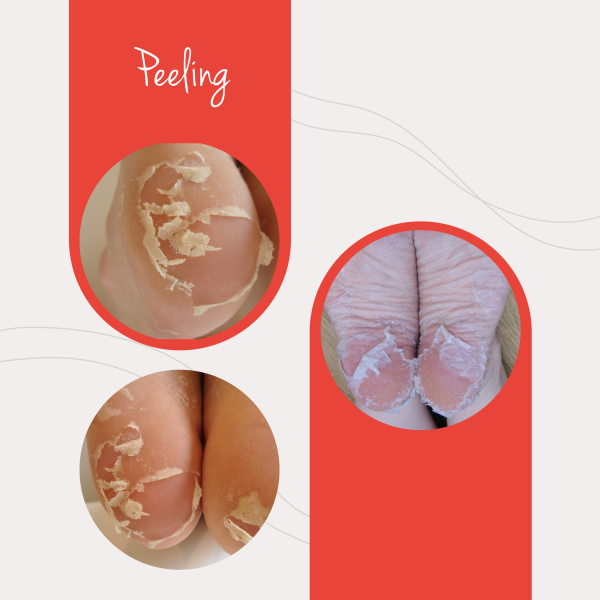 Baby Foot® Exfoliating Foot Peel Mint - Image 4